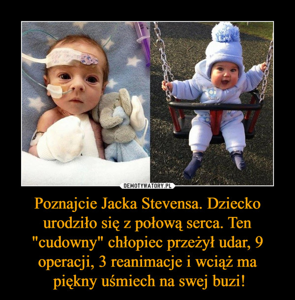 Poznajcie Jacka Stevensa. Dziecko urodziło się z połową serca. Ten "cudowny" chłopiec przeżył udar, 9 operacji, 3 reanimacje i wciąż ma piękny uśmiech na swej buzi! –  