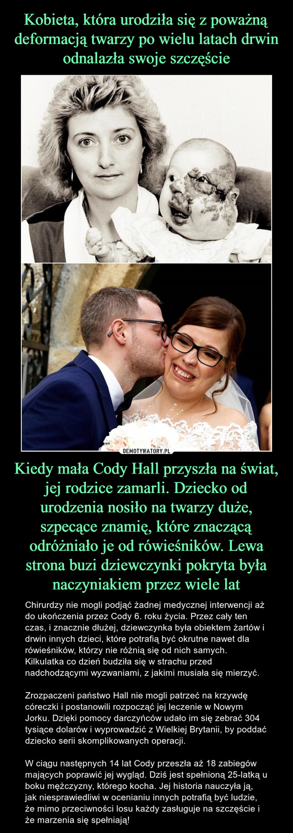 Kiedy mała Cody Hall przyszła na świat, jej rodzice zamarli. Dziecko od urodzenia nosiło na twarzy duże, szpecące znamię, które znaczącą odróżniało je od rówieśników. Lewa strona buzi dziewczynki pokryta była naczyniakiem przez wiele lat – Chirurdzy nie mogli podjąć żadnej medycznej interwencji aż do ukończenia przez Cody 6. roku życia. Przez cały ten czas, i znacznie dłużej, dziewczynka była obiektem żartów i drwin innych dzieci, które potrafią być okrutne nawet dla rówieśników, którzy nie różnią się od nich samych. Kilkulatka co dzień budziła się w strachu przed nadchodzącymi wyzwaniami, z jakimi musiała się mierzyć. Zrozpaczeni państwo Hall nie mogli patrzeć na krzywdę córeczki i postanowili rozpocząć jej leczenie w Nowym Jorku. Dzięki pomocy darczyńców udało im się zebrać 304 tysiące dolarów i wyprowadzić z Wielkiej Brytanii, by poddać dziecko serii skomplikowanych operacji. W ciągu następnych 14 lat Cody przeszła aż 18 zabiegów mających poprawić jej wygląd. Dziś jest spełnioną 25-latką u boku mężczyzny, którego kocha. Jej historia nauczyła ją, jak niesprawiedliwi w ocenianiu innych potrafią być ludzie, że mimo przeciwności losu każdy zasługuje na szczęście i że marzenia się spełniają! 