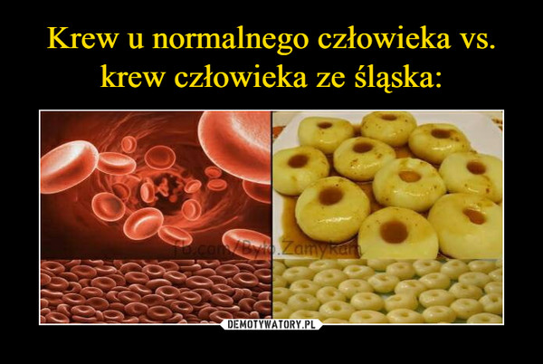 Krew u normalnego człowieka vs. krew człowieka ze śląska:
