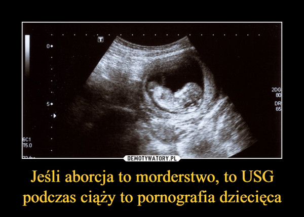 Jeśli aborcja to morderstwo, to USG podczas ciąży to pornografia dziecięca –  